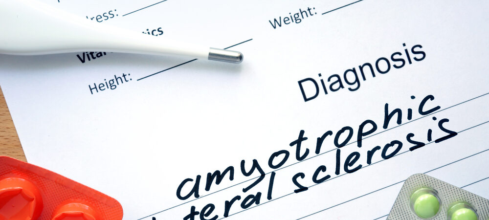 An introduction to amyotrophic lateral sclerosis (ALS) and its causes