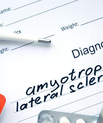 An introduction to amyotrophic lateral sclerosis (ALS) and its causes